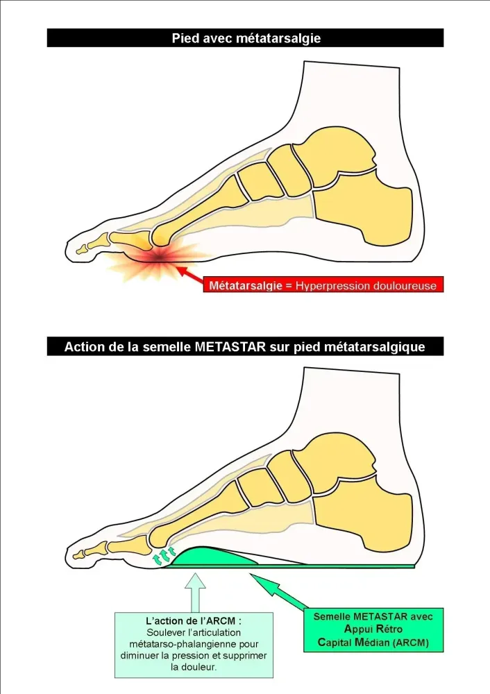 semelle ortho (4)