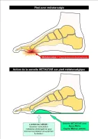 semelle ortho (4)
