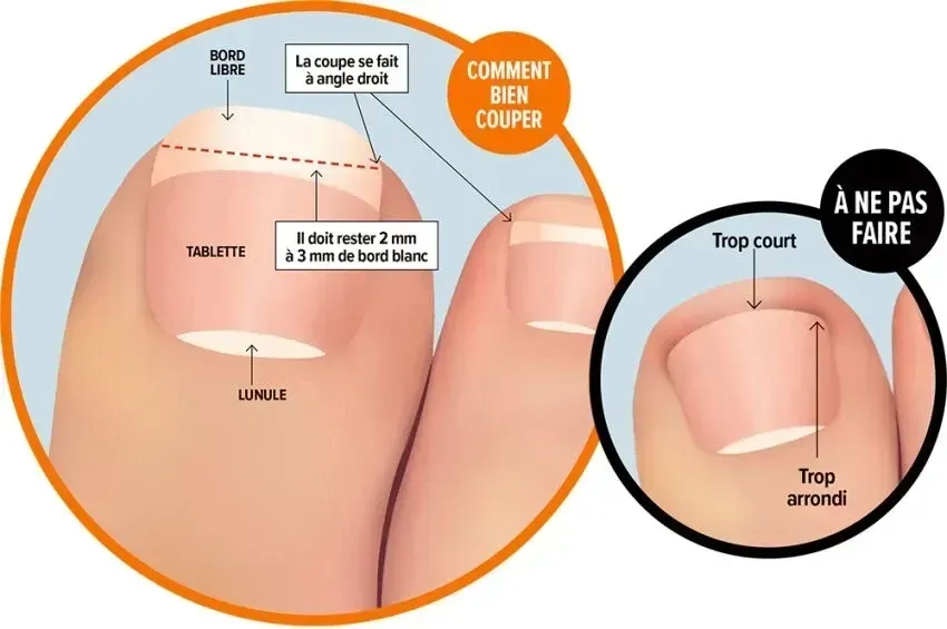Coupe des ongles : erreurs à éviter et risques