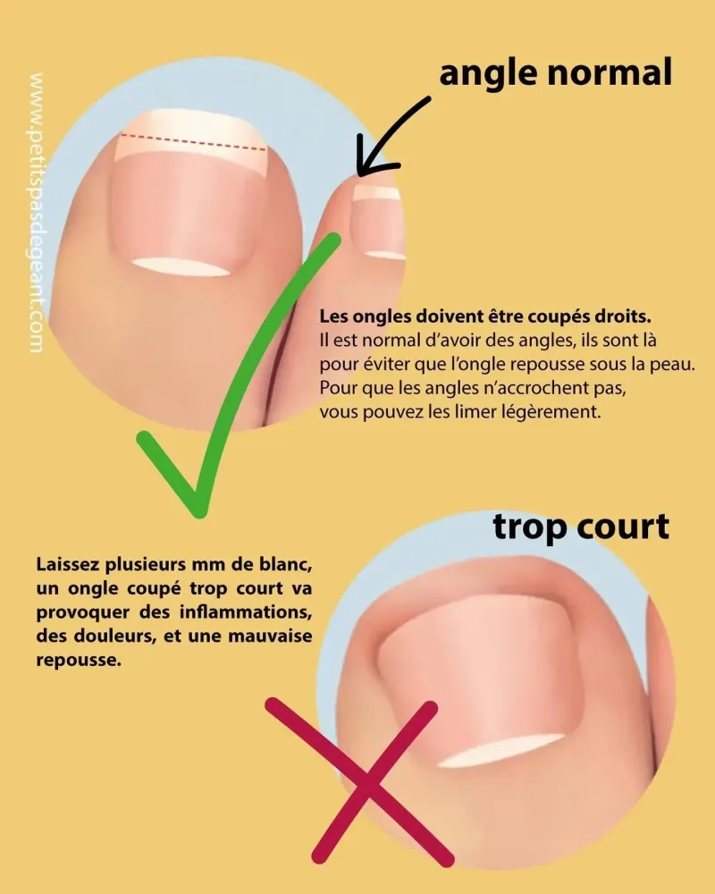 coupe ongle (4)