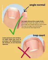 coupe ongle (4)