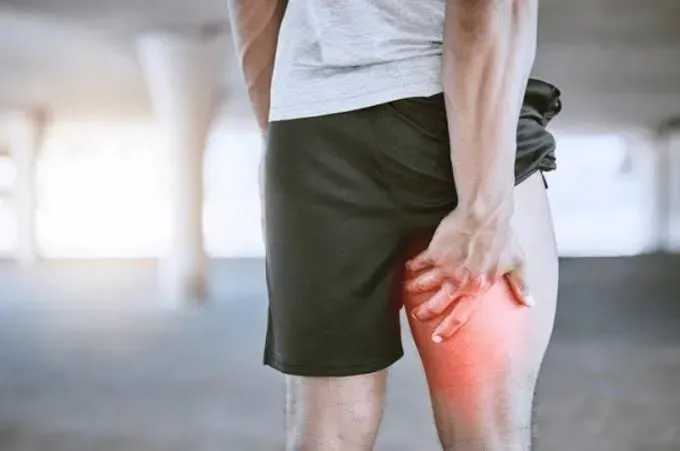 déchirure musculaire.webp